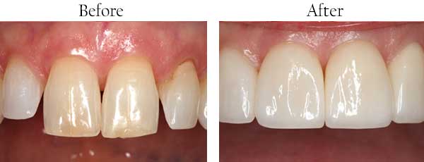 dental images 33950